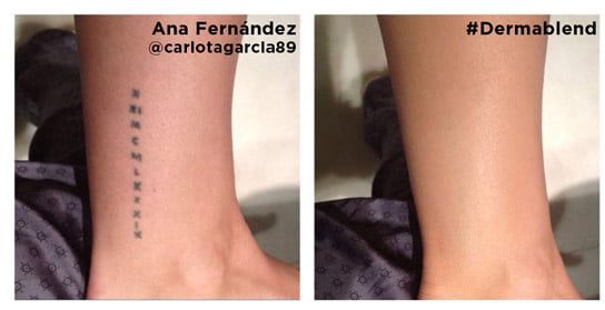 Descubre todo el potencial de Dermablend de Vichy 3 ana_fernandez_4447_544x279