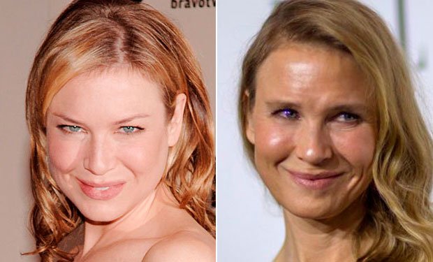 Renée Zellweger y como el exceso de cirugía pasa factura