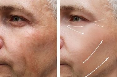 Consejos para elegir la mejor crema antiarrugas para hombres: guía paso a paso